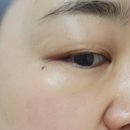 가위필 | 셀리맥스 지우개 시카 파하 필 투스텝 겔 마스크 솔직 후기 (왕면봉 각질 제거+진정 꿀팁)