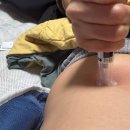 고봉약국 | 광주 마운자로 3주차 후기, 체중 감량 효과 솔직 공개