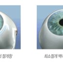 잠실서울밝은안과의원 이미지