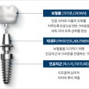 에버티스임플란트