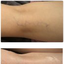 힐링라라샵 이미지