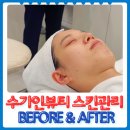 처인구 피부관리 수가인뷰티 용인둔전점 전후 후기!