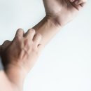 알레르기 이미지