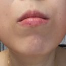 아우라오라 팔자주름마사지기 사용 후기