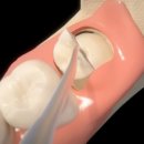 서울이다움치과 이미지