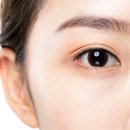 꼼꼼성형외과의원 네이버블로그