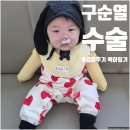 이동1통 | 구순열 수술 입원 후기 아기 수술 준비물 리스트 &amp; 병원 생활 현실