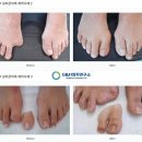 한국의지보조기학회 이미지