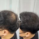 일산두피&눈썹단미토탈뷰티