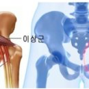 테피티 이미지