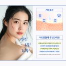 선피부관리 - 양평군 | 선피부관리