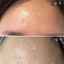 준메디케어 이미지