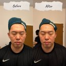 세븐일레븐 광주와이어스파크점 | 광주 남자피부관리｜홍조·붉은톤 고민 해결! 로라뷰티하우스 신랑관리 후기