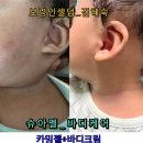 [보령인셀덤] 제품후기 사진 감사합니다!