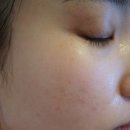 엘에이치바이오 이미지