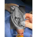 뉴본동물의료센터 | 동탄동물병원 강아지 성장판 골절 경골 조면 골절 수술 후기