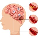 더나은신경과의원 이미지