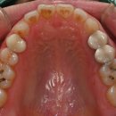 OK치과기공소 이미지