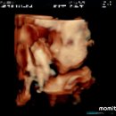 내도정비소 | [임신 일기] 유도분만 입원 당일 폭풍 전야