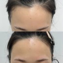 마곡 &lt;차윤왁싱&gt; 깔끔한 웨딩촬영을 위한 헤어라인 + 눈썹 왁싱 후기.