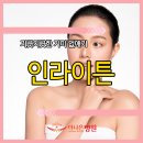 인라이튼