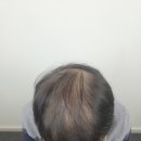 하프톤 스칼프 네이버블로그