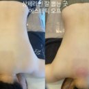 에스테틱오프
