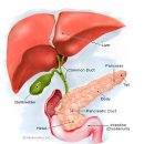 췌장암의 표준치료법 그리고 통합의학적 치료 이미지