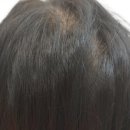 서연생고기 - 달성군 | 뿌리매직성지에서 해드린 뿌리매직후기 대학동미용실