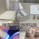 리베 | 울산 피부관리 진스킨 달동 피부샵 문제성 여드름 리베룩 후기
