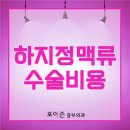 하지정맥류수술비용 궁금증을 풀어드립니다. 이미지