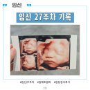은꽃 - 수원시 팔달구 중부대로 177 | 임신 27주차 입체초음파, 임당검사(임신성당뇨검사), 임당재검사 후기