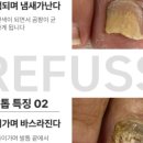 레푸스진주대안점