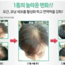 오랫만의 샴푸 후기[아토퀵 샴푸]탈모샴푸