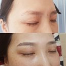 뷰티라썸