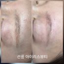 아이리스 뷰티#