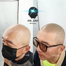 7488 | 군포.새솔동.시흥.안산.배곧.동탄.광교.인천.송도.천안.대전.화성.일산.성남 부분탈모 smp 두피문신학원