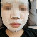뷰티온의원 별내점 | (내돈내산) 뷰티온의원 별내점 방문후기(점제거, 줌 패스)