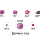 특발성 혈소판 감소성 자반증 (Idiopathic thrombocytopenic purpura) 이미지