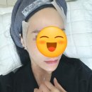 과천예일의원 | 과천예일의원 부설 미소지앤 피부관리 센터 카본 토닝 모공 레이저 후기,