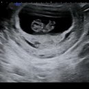 오복산전 이미지