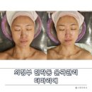에스테틱마리에 | 의정부 민락동 얼굴 윤곽관리 잘하는 곳 - 더마리에 솔직 후기