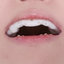 디메디 | 이갈이 고요S 내돈내산 후기 (디메디코리아 스토어)