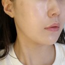 장자대로86번길 | 구리 피부관리 수택동 미래앤스킨케어 피부관리 후기