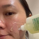 홈케어 뷰티디바이스 꿀조합 수딩젤 그린박신스트롱 파이토신 재생크림 내돈내산 후기