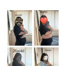 포엘여성의원 네이버블로그