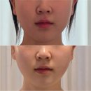 구산로 | [김해/구산동] 김해 구산동 에스테틱 백퍼센트 스킨앤바디 윤곽 / 피부관리 솔직 후기