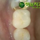 허브 치과기공소 이미지