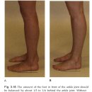 ankle arrow로 이해하는 발의 생체역학 이미지