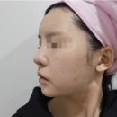 아이필유의원 네이버블로그